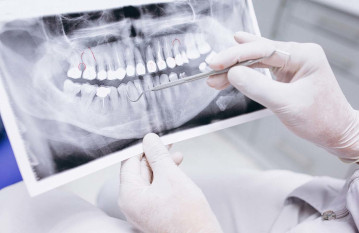 Рентген: снимок зубов