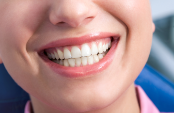 6 часто задаваемых вопросов стоматологу