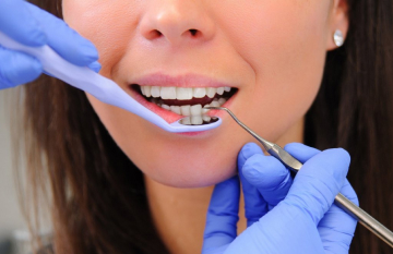 Пародонтоз: лечение дома и у стоматолога