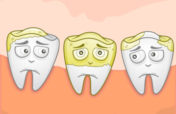 Генерализованный кариес: запущенный процесс разрушения зубов